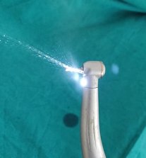 330px-Dental_aerosols